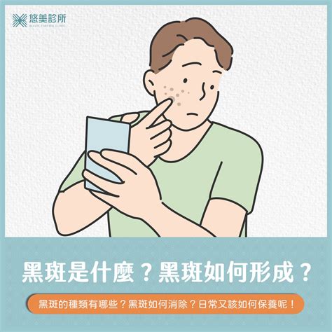 手臂黑斑|如何去除黑斑？雷射治療與預防方法的建議，以及黑斑。